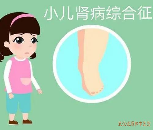 儿科专家门诊王大宪教授：小儿脾肾两虚双下肢略有水肿有泡沫尿中医怎么治疗?
