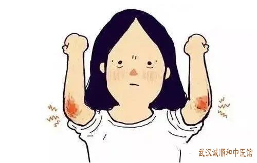 武汉有名的疼痛名老中医柳新樵：网球肘关节活动受限慢性疼痛中医治疗效果怎么样?