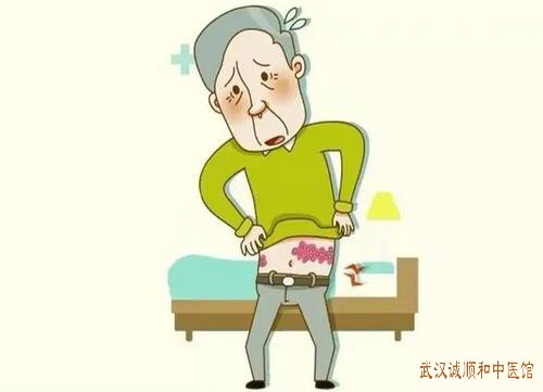 湖北省中医院皮肤科主任王儒英：左肋部疼痛出现疱疹皮肤发热吃什么中药可以治?