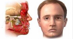 面瘫导致面部表情不对称、不能皱眉闭眼等，中医治疗方法多且有效果。