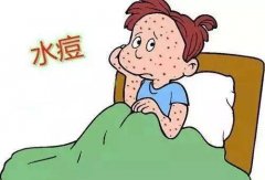 水痘会引起发热和黏膜成批皮损且传染性极强，中医如何治疗和护理？
