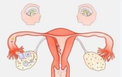 女性月经期外大量出血或是出血不止，中医如何治疗功能性子宫出血？