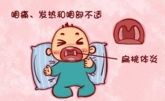 王大宪：小儿扁桃体发炎吃什么中药比较好？
