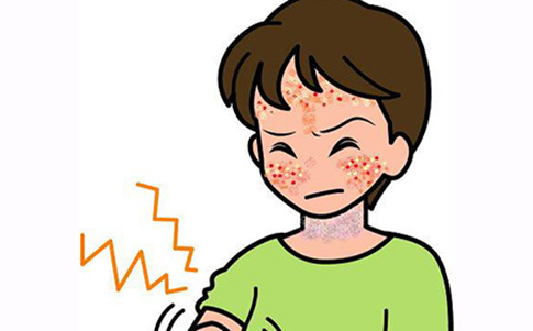 神经性皮炎身上长丘疹瘙痒吃什么中药？