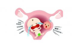 妇科专家廉河清：人流两次得了子宫肌瘤对怀孕有影响吗，吃什么中药效果