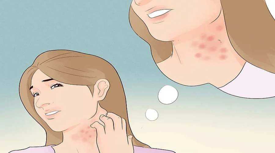 慢性湿疹怎么治疗？