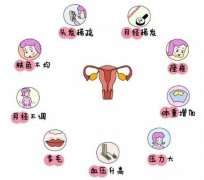 看妇科有名的姜瑞雪教授：月经不调形体偏胖不孕，多囊卵巢综合征中医治