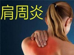 肩关节疼痛剧烈牵及右臂怎么治疗好？