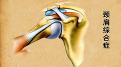 颈肩关节疼痛疲劳肌肉紧张有什么好的缓解方法？颈肩综合征中医怎么治？