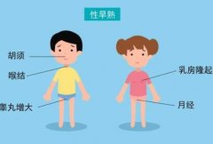 武汉中医儿科鲁本堂：12岁女孩性早熟发育过早3年乳房胀痛骨龄超2岁怎么治