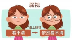 武汉有名的眼科中医博士丁辛：儿童弱视看不清怎么办还能恢复视力吗？