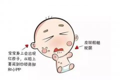 有名的儿科中医王大宪：2岁男孩双腿手臂手背有红色疹子很痒中医可以治疗