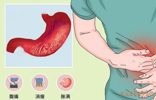 萎缩性胃炎中医治疗医案