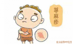 中医胡爱玲：后背四肢皮肤大面积发红瘙痒剧烈慢性荨麻疹吃中药有用吗？