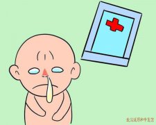 儿科疑难杂症专家李轩锦：冬天吹空调后反复鼻塞流涕伴鼻痒中医能调理吗