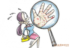 疑难皮肤病专家胡爱玲：经常做家务慢性手部湿疹反复中医治疗有效果吗？