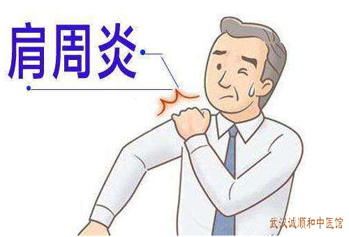 肩周炎中医治疗医案