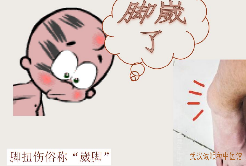 踝关节扭伤熊勇中医治疗医案