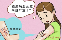 中医胡爱玲：全身泛发点状红斑丘疹鳞屑伴瘙痒2年余内服中药治疗有效吗？
