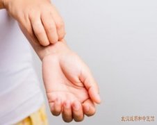 王儒英皮肤看的怎么样?手足干裂起角化性斑片瘙痒难治吃中药有效果吗?