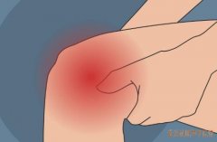 手指关节、肩、膝、踝关节肿胀热痛，中医孔政怎么治疗类风湿性关节炎？