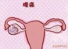 武汉中南路妇科门诊黎诗祺医师：月经不调经期腹痛伴经期长该怎么调理？
