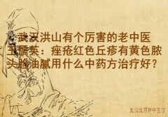 武汉洪山有个厉害的老中医王儒英：痤疮红色丘疹有黄色脓头脸油腻用什么