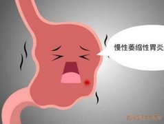 武汉中南路中医博士丁辛：慢性萎缩性胃炎上腹轻度压痛中医怎么治疗？