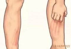 小腿皮肤瘙痒天气干燥时脱皮得厉害是什么原因吃什么中药治疗好？