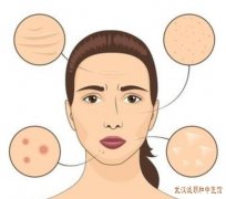 脸上皮肤爱出油长痘痤疮中医怎么辨证分型治疗?
