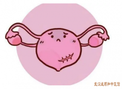 武昌区中医妇科门诊：子宫腺肌病月经量大经期过长小腹坠胀吃中药调理有