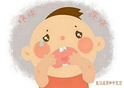武昌附近厉害的皮肤病中医：小儿口腔疱疹嘴巴里起疱疹疼痛怎么治？