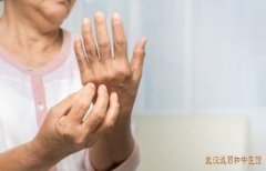 手部湿疹顽固难愈反反复复发作要怎么治疗能好得快?