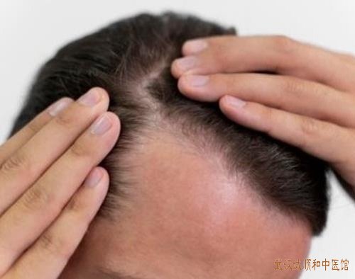 武汉中南路厉害的皮肤科名医：头癣这种病有哪些治疗方法?