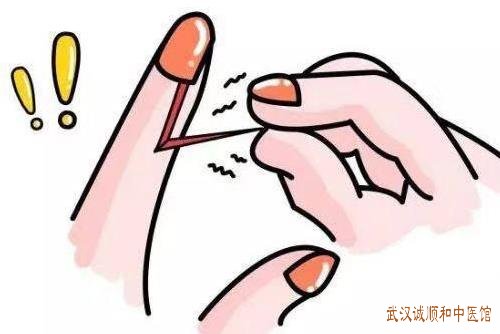 武汉宝通寺附近有位厉害的老中医：甲沟炎手指头肿胀疼痛怎么治？