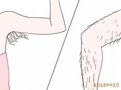 武汉街道口厉害的皮肤科专家：吃药后汗毛变多更粗怎么恢复正常？