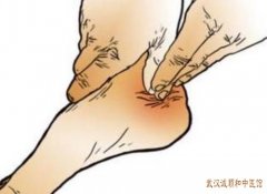 武汉洪山区有个厉害的老中医：足底筋膜炎早起落地时疼痛明显怎么治？