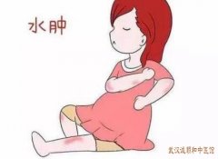 武汉洪山广场有位中医疑难杂症专家：紫癜伴稍水肿呈对称性神疲乏力四肢