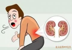 武汉地铁黄金口厉害的中医内科专家：腰酸楚乏力反复感冒时自汗出怎么治