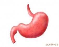 武汉雪松路有个治胃炎厉害的老中医：慢性浅表性胃炎胃脘灼热大便溏口苦