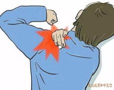 武汉治肩周炎的中医哪家好?35岁中年男性肩部刺痛固定活动受限伴随着疼