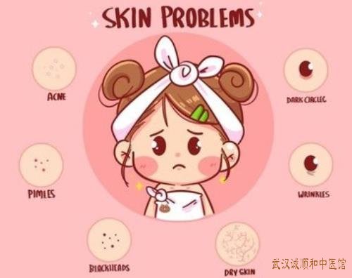 武汉中南路有个看皮肤厉害的老中医王儒英：针对皮肤多脂起屑面颊皮肤红痒有用的中药方。