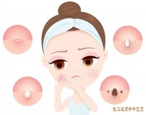 中医皮肤科专家王儒英：颜面皮肤瘙痒2月余过敏性皮炎喝中药有用吗?