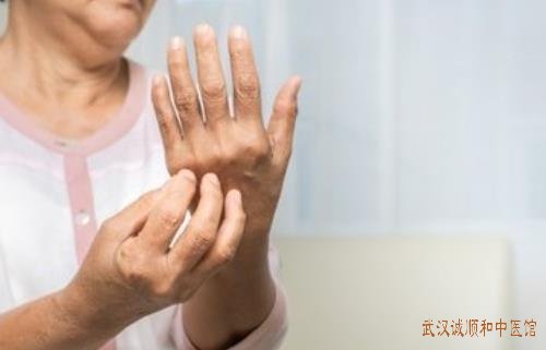 中医如何看待玫瑰糠疹如何减少复发提高发病期的生活质量?