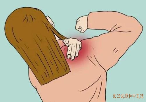 武汉武昌区有位看骨病的老中医：每天久坐出现肩颈酸痛动作不灵活怎么调？