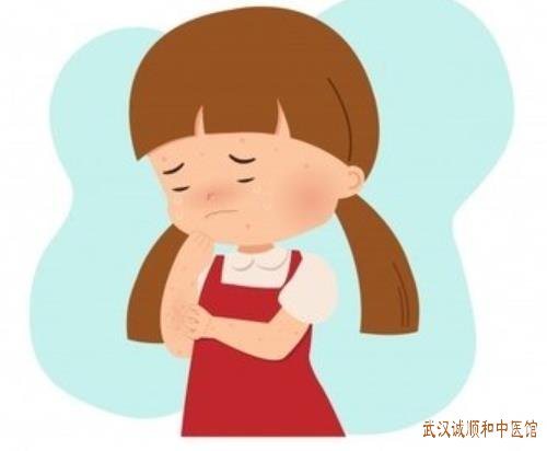 武汉中南有名的中医儿科医院:上呼吸道感染疱疹性咽峡炎中医怎么用药效果好?