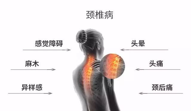 颈肩酸痛手臂麻痛得了颈椎间盘突出怎么办？