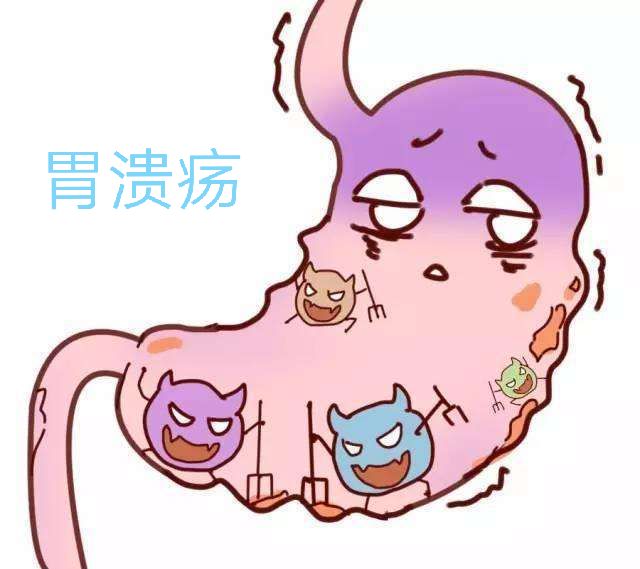 胃溃疡