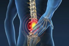 急性腰扭伤后可做哪些应急处理防止情况加重？