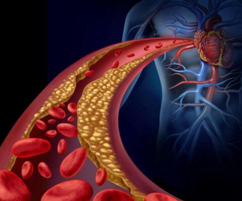 中医辨证治疗心脑血管疾病的特色